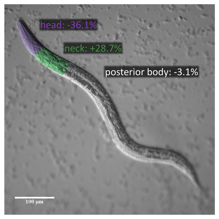 A non-functioning UNC-83 UNC-84 LINC complex leads to displaced body wall muscle nuclei in C. elegans