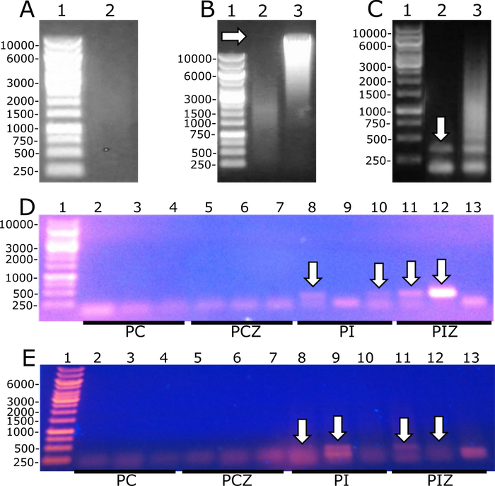 T. cruzi is detected in fixed placentas and fetuses by PCR after genomic DNA extraction